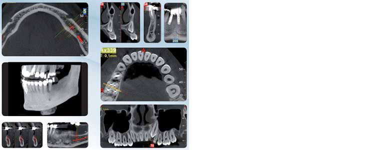Dentascan