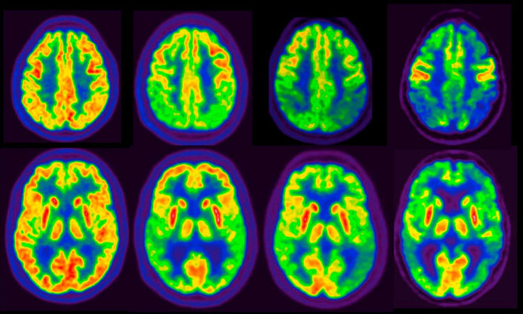 Pet-Tac Cerebrale a Guidonia-Roma presso lo Studio Radiologico - Prenota l'esame  Pet-Tac Cerebrale a Guidonia-Roma presso lo Studio Radiologico - Prenota l'esame