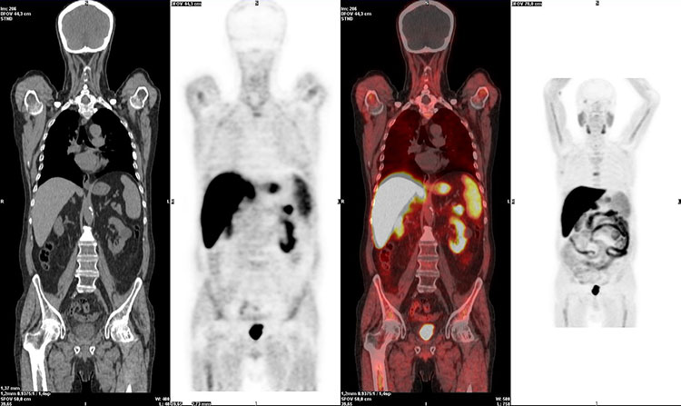 Pet-Tac con Colina di ultima generazione a Guidonia-Roma presso lo Studio Radiologico - Prenota l'esame