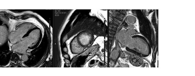 Rm Cardiaca Rm Cardiaca