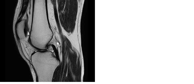 RM Ginocchio RM Ginocchio