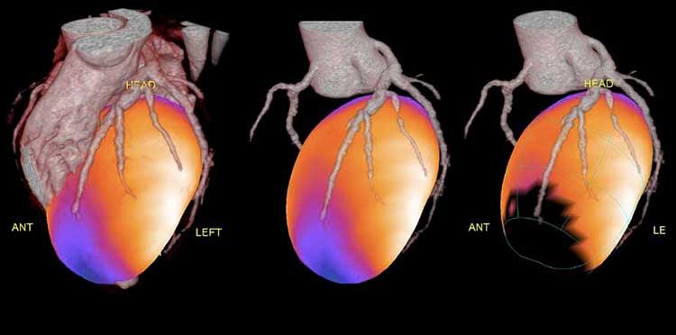 Scintigrafia miocardica a Guidonia-Roma presso lo Studio Radiologico - Prenota l'esame